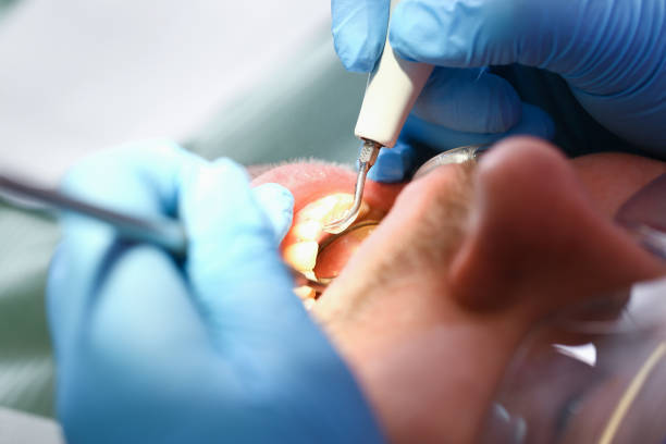 Best Walk-In Emergency Dental Services in Heidelberg, TX